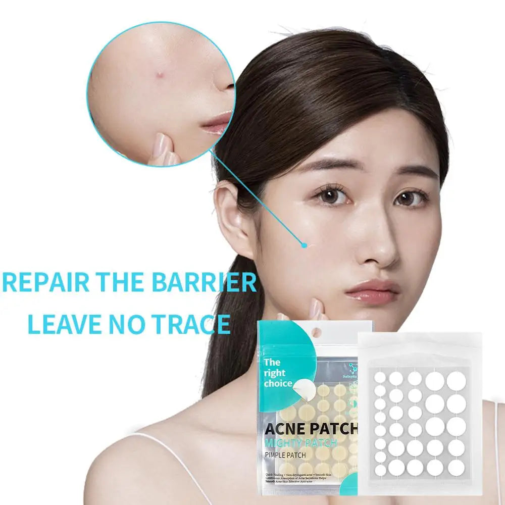 Hydrocolloid Salicylic Acne Patches – 30pcs Pimple Spot Treatment