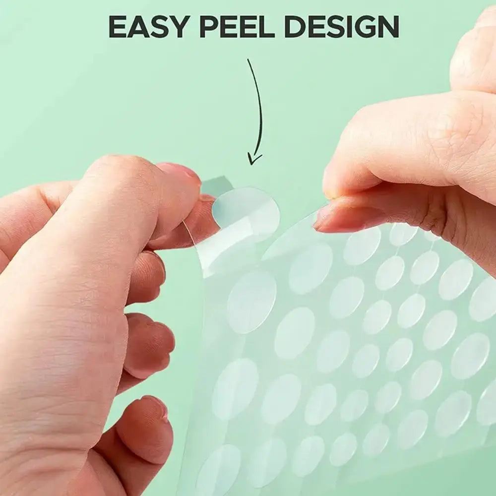 Hydrocolloid Salicylic Acne Patches – 30pcs Pimple Spot Treatment