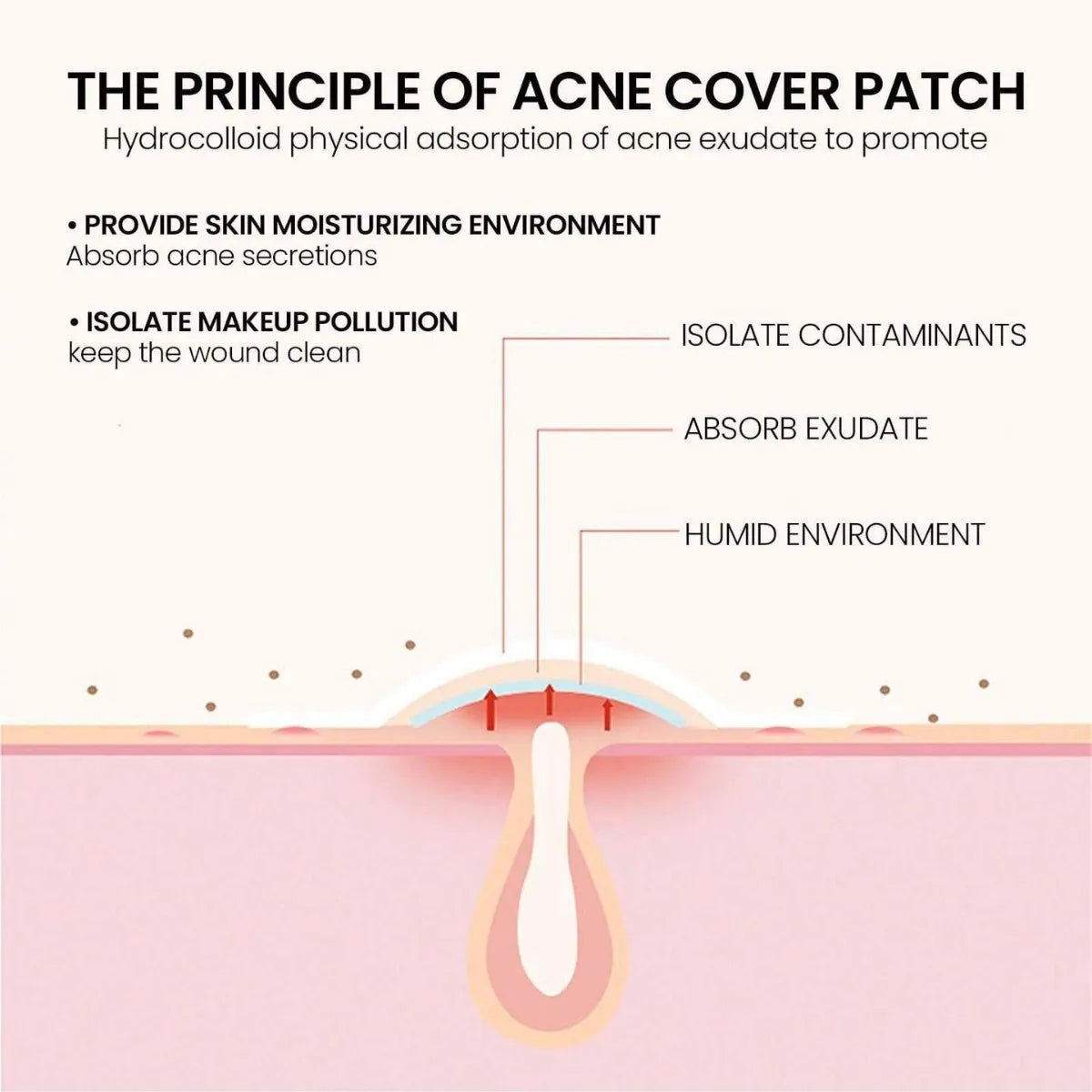 Star Hydrocolloid Acne Patches – 200pcs in 5 Cute Colors