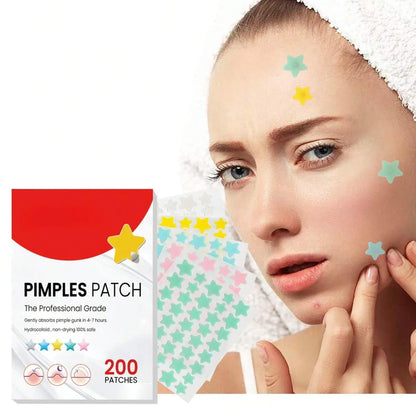 Star Hydrocolloid Acne Patches – 200pcs in 5 Cute Colors