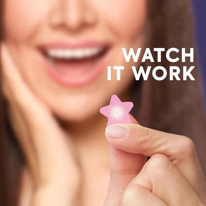 Star-Shaped Pimple Patches – 432pcs Cute Hydrocolloid Stickers