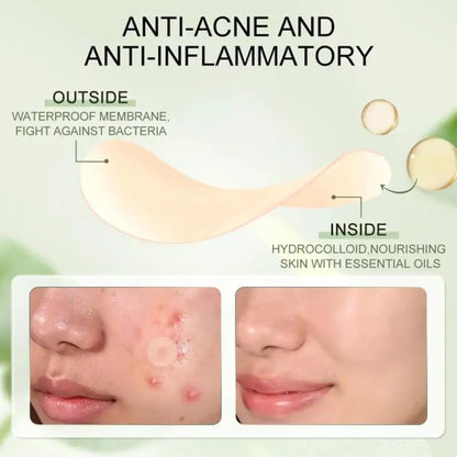 Hydrocolloid Salicylic Acne Patches – 30pcs Pimple Spot Treatment