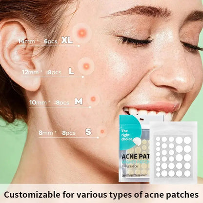 Hydrocolloid Salicylic Acne Patches – 30pcs Pimple Spot Treatment