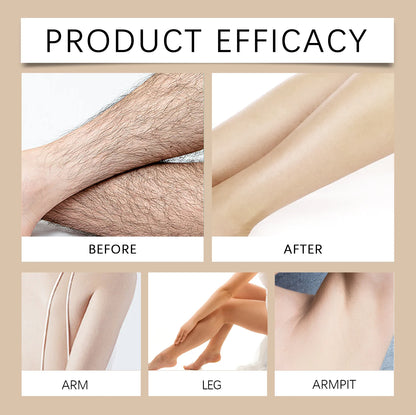 Rozino Facial Hair Removal