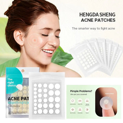 Hydrocolloid Salicylic Acne Patches – 30pcs Pimple Spot Treatment